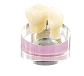 オールセラミック